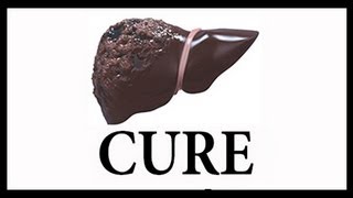 Part 1 of 5 LIVER CIRRHOSIS CURES  Natural Cure Treatment Remedy Liver Flush Protocol [upl. by Tesler]