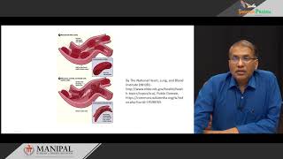 32 Hemoglobinopathies [upl. by Hild]