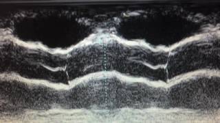 Echocardiogram basic Dr André Chiga [upl. by Cassondra]