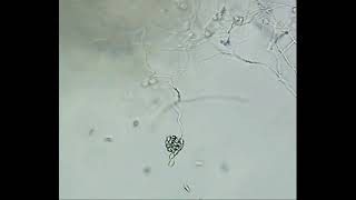 Release of Zoospores by Pythium sp [upl. by Aluin]