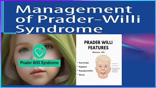 🔴What Is PraderWilli Syndrome ❓He also may have these symptoms👀👀 [upl. by Sokem596]