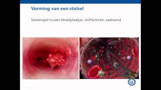 Hemostase deel 1 Inleiding  Prof dr REG Schutgens [upl. by Daniala936]