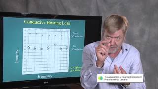 Ted Venema Talks Reading the Audiogram [upl. by Nerrual]