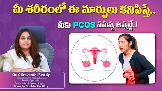 PCOS Polycystic Ovary Syndrome Diagnose amp Symptoms in Telugu  ShubhaFertility [upl. by Cornelia]