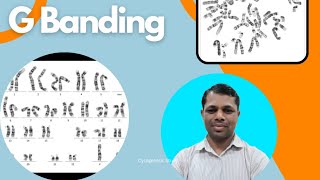 GTG banding mechanism amp procedure G banding Giemsa banding [upl. by Valli749]