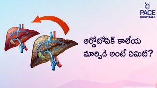 Orthotopic Liver Transplantation  ఆర్థోటోపిక్ కాలేయ మార్పిడి అంటే ఏమిటి [upl. by Drofniw]