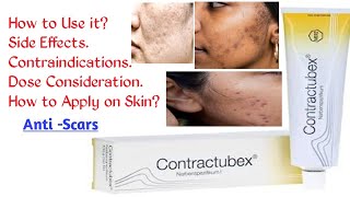 CONTRACTUBEX GEL  How to Use Side Effects Contraindications Daily Dose  AntiScaring Gel [upl. by Argent]