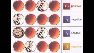 Understanding Blood Type Results  Review and Practice [upl. by Anaul]