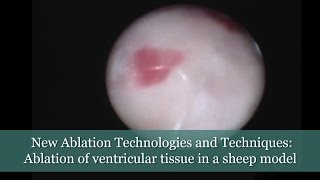 New Ablation Technologies and Techniques  Ablation of ventricular tissue in a sheep model [upl. by Arikaahs]