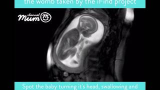 MRI Scan Video of Baby Moving in Womb  Channel Mum [upl. by Arly]