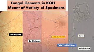 KOH mount of various samples with variety of Fungal elements [upl. by Pritchett]