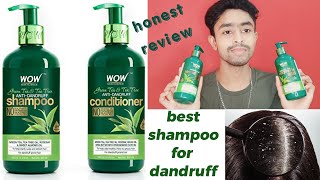 Wow green tea anti dandruff shampoo and conditioner review  best shampoo for dandruff  wow shampoo [upl. by Eceerehs]