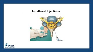 Intrathecal Injections [upl. by Idisahc]