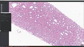 Annotate Glomeruli and Tubules using QuPath and Segment Anything Plugin [upl. by Laurin700]