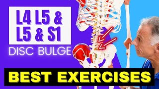 L4 L5 amp L5 S1 Disc Bulge Best Exercises Rehab For Relief [upl. by Nnaul726]