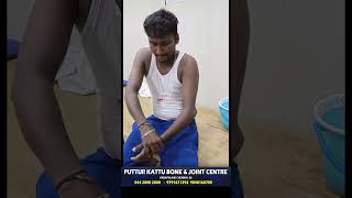 elbow dislocation treatment  முழங்கை மூட்டு விலகல்  vadapalani  puttur kattu [upl. by Eirb]