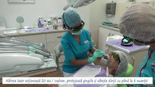 Albirea dintilor cu laser la Clinica EXCEDENT [upl. by Nuarb]