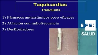 Tratamiento de las arritmias de taquicardia fármacos ablación y desfibrilador [upl. by Revolc]