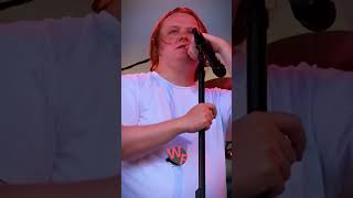 You wont believe what the audience did to this singer with Tourette syndrome [upl. by Arrec880]