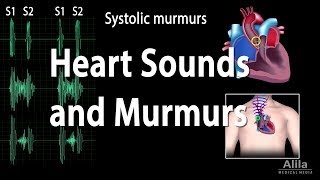 Heart Sounds and Heart Murmurs Animation [upl. by Merci]