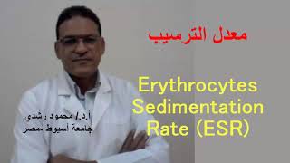 Erythrocytes Sedimentation rate ESR  معدل ترسيب خلايا الدم الحمراء [upl. by Yelsnik]