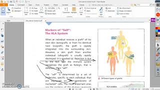 Types of grafting Grade 8 [upl. by Sydney]