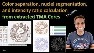 344 Color separation and nuclei segmentation in cores extracted from TMA [upl. by Modla875]