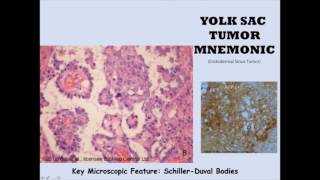 Yolk Sac Mnemonic [upl. by Ymas149]