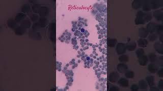 Reticulocyte 🩸🔬💉🦠🧬🧫❤️mlt bmlt dmlt youtubeshorts shorts [upl. by Aihtekal]