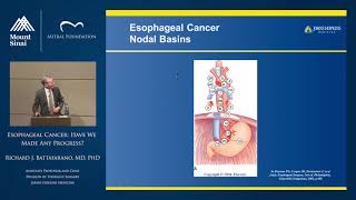 Esophageal Cancer Have We Made Any Progress [upl. by Norby]