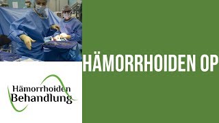 Hämorrhoiden OP  Welche Möglichkeiten gibt es für dich  Hämorrhoiden Operation [upl. by Barny864]