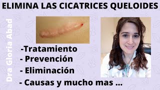 CICATRICES QUELOIDES ▶ Causas prevención y tratamientos ✅ [upl. by Aderb]