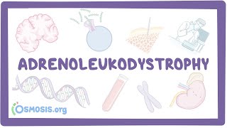 Adrenoleukodystrophy  causes symptoms diagnosis treatment pathology [upl. by Trotta]