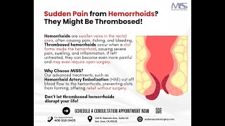 Sudden Pain from Hemorrhoids Might be Thrombosed [upl. by Allister]