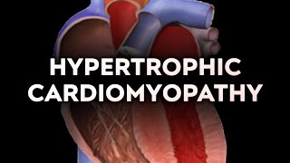 Hypertrophic Cardiomyopathy HCM [upl. by Marceau]