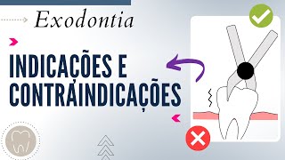 INDICAÇÕES E CONTRAINDICAÇÕES PARA EXODONTIAS [upl. by Yelad]