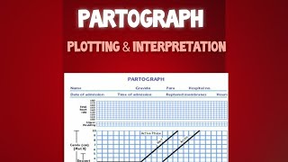 Plotting and Interpretation of Partograph [upl. by Carling]