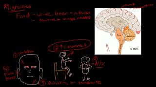 Migraine pathophysiology [upl. by Clerc]