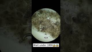 quotDog saliva magnified 400X is so coolquotunderthemicroscope [upl. by Eelatan502]