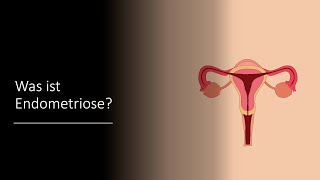 Was ist Endometriose  Ein Erklärvideo [upl. by Shreeves]