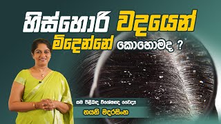 ඉස්හොරි වලට විසදුම්  Dandruff Treatments in Sinhala  Dr Nayani Madarasinghe [upl. by Pillow]