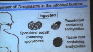 DrAzaa 10  Toxoplasmosis [upl. by Sheri]