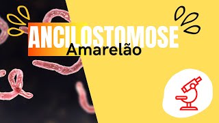 ANCILOSTOMOSEANCILOSTOMÍASE AMARELÃO [upl. by Anniroc461]