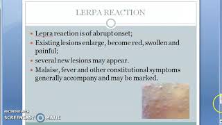 Pharmacology 770 c Anti Leprosy MultiDrug Therapy Lepra Reaction Paucibacillary Multibacillary MDT [upl. by Auqinaj]