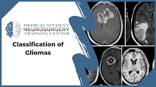 Classification of Gliomas [upl. by Arym9]