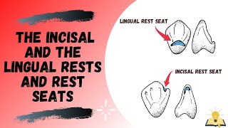 Incisal and the Lingual Rest and Rest Seat  Part III  Removable Partial Denture RPD [upl. by Inessa91]