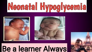 Neonatal Hypoglycemia [upl. by Verneuil427]