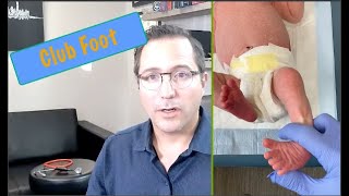 Club Foot 101 What Every Parent Needs to Know  Lets Talk About PAK Pediatrics [upl. by Ahsael848]