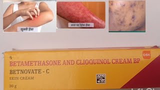 Betnovate C Cream Use Betnovate c cream review Composition Price and Side Effects in Hindi [upl. by Tterag]