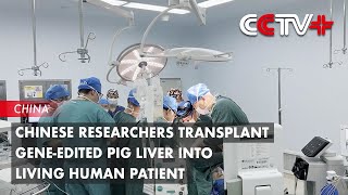 Chinese Researchers Transplant Geneedited Pig Liver into Living Human Patient [upl. by Adla173]